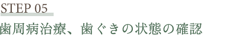 歯周病治療、歯ぐきの状態の確認